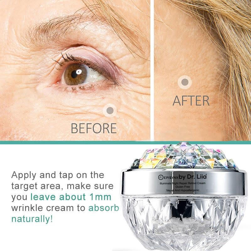 Illuminate Night Repair Retinol Cream for Glowing and Smooth Skin