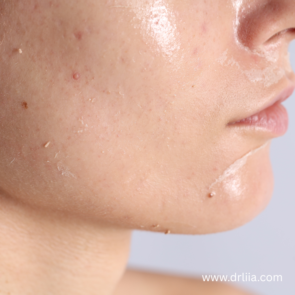 dr liia skincare